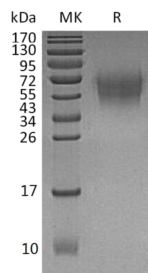 Human DNAM-1 +SDS-PAGE-2.jpg